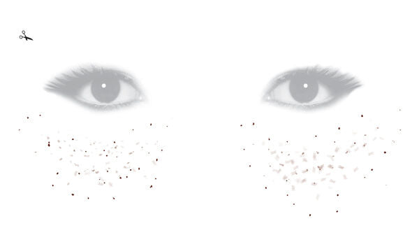 FRECKLE-14